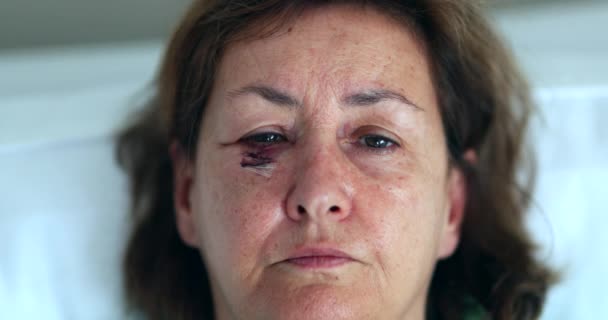 Mulher Mais Velha Com Hematomas Rosto Cicatriz Abrir Olhos Olhando — Vídeo de Stock