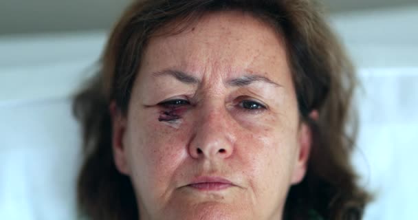 Mulher Mais Velha Com Olhos Cicatrizados Abertura Dos Olhos Após — Vídeo de Stock