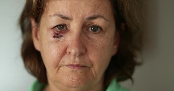 Ältere Frau Mit Verprügeltem Gesicht Und Narbe Schüttelt Missbilligend Den — Stockvideo