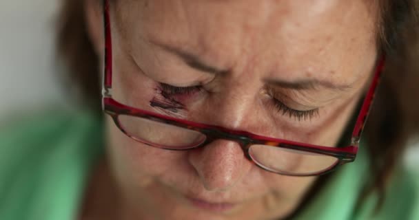Mulher Mais Velha Com Hematomas Usando Vidro Leitura — Vídeo de Stock