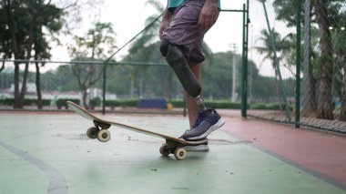 Kaykaycı protez bacağıyla ayakta duruyor. Kaykaylı ve yapay bacaklı engelli kişi