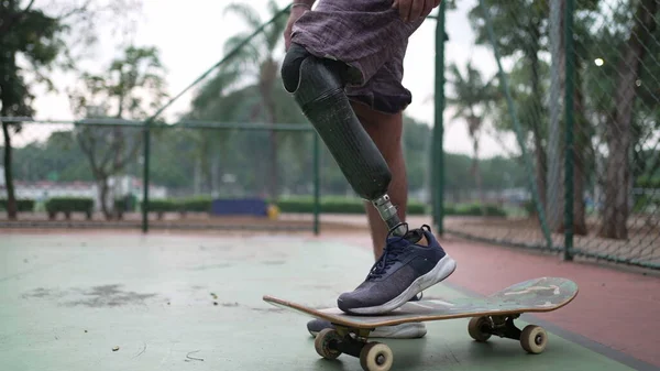 Skateboarder Steht Mit Beinprothese Behinderte Mit Skateboard Und Beinprothese — Stockfoto