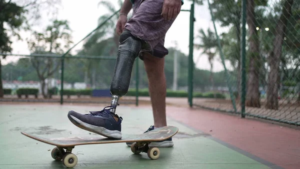 Kaykaycı protez bacağıyla ayakta duruyor. Kaykaylı ve yapay bacaklı engelli kişi