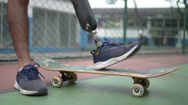 Nahaufnahme Behinderter Mit Beinprothese Steht Auf Skateboard — Stockfoto