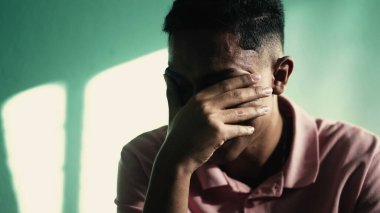Depresyondaki genç adam yüzünü eliyle kapatıyor ve ANXIETY hissediyor. TRAUMA 'yı hatırlayan olumsuz duyguları olan acı çeken kişi.