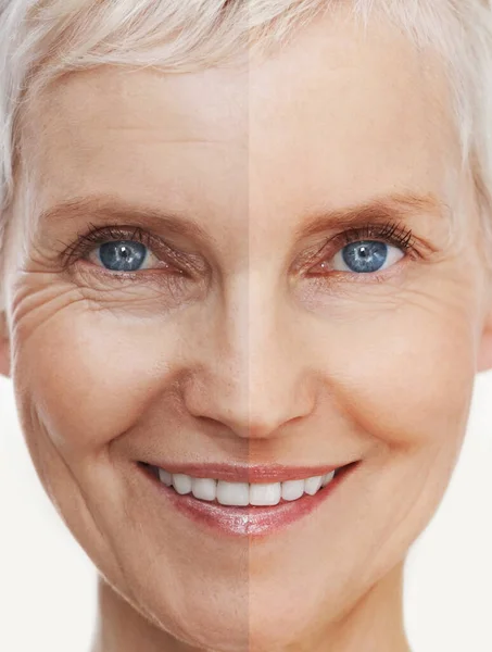Anmutig und schön altern. Vorher-Nachher-Aufnahme eines schönen Seniorinnen-Gesichts. — Stockfoto