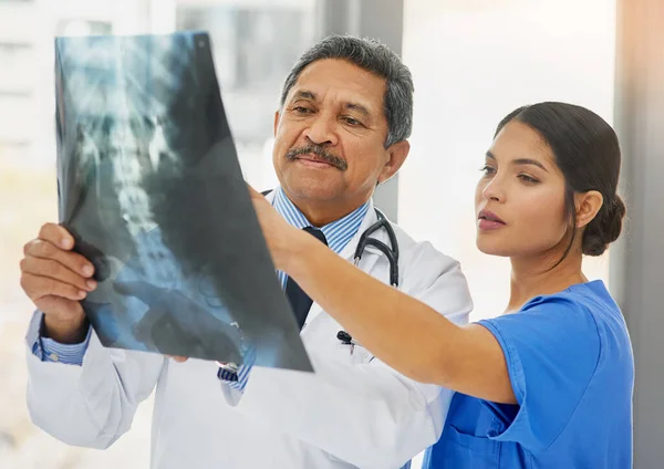 看透了这个问题。拍了一个成熟的医生和一个年轻的护士一起看X光片. — 图库照片