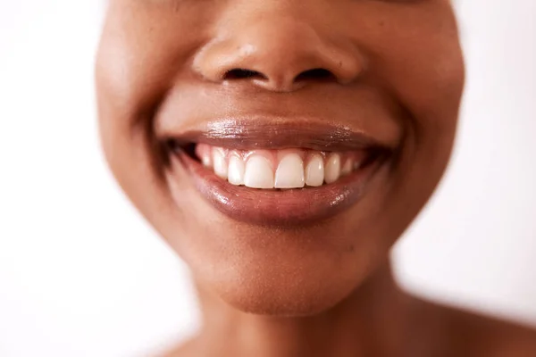 Ett leende kan förändra världen. Studio skott av en oigenkännlig kvinna ler mot en vit bakgrund. — Stockfoto