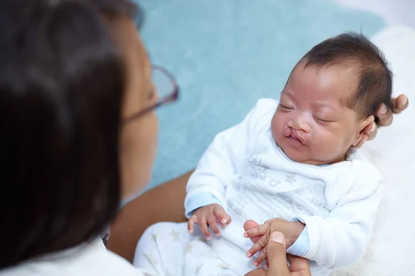 Trost finden in den Armen ihrer Mutter. Aufnahme eines schlafenden Mädchens mit Gaumenspalte, das von seiner Mutter gehalten wird. — Stockfoto