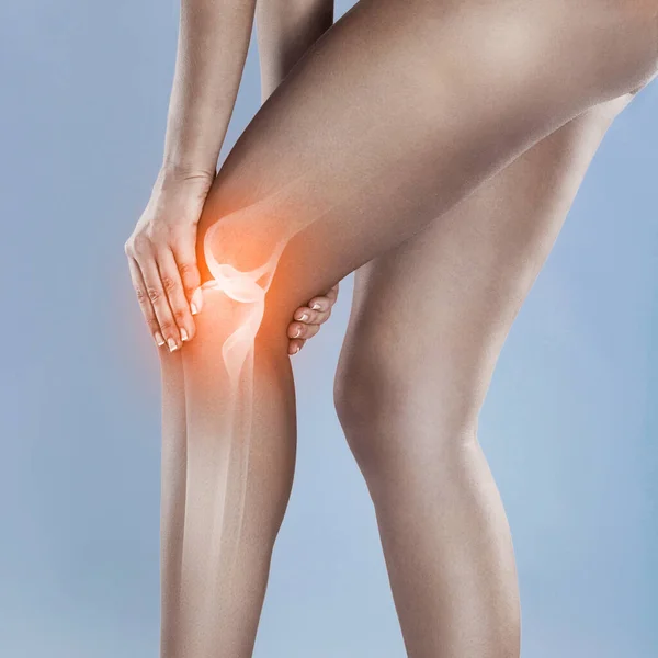Urazy kolana mogą się utrzymywać. Koncepcja ujęcia kobiety z bolesnym stawem kolanowym. — Zdjęcie stockowe