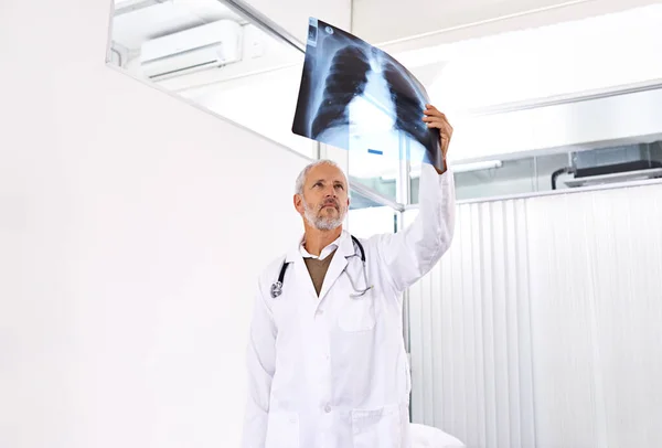 看看你的胸腔一名在医院检查X光照片的成熟男医生中弹. — 图库照片