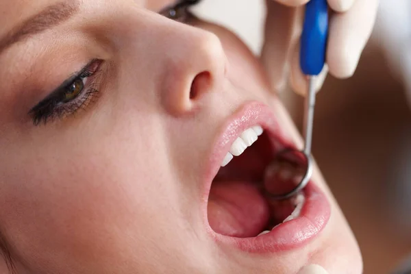 Chequeo oral. Primer plano de los pacientes abrir la boca antes del chequeo oral. — Foto de Stock