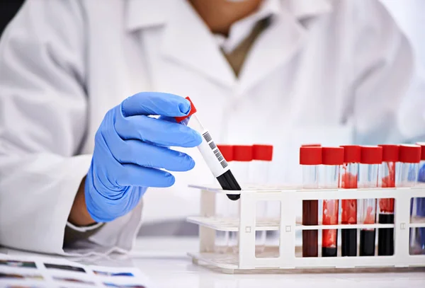 Ready to analyze some blood. Cropped shot of a male scientist conducting blood tests in a medical lab. — Stock Photo, Image