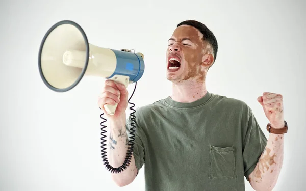 Sprechen Sie, auch wenn Ihre Stimme zittert. Studioaufnahme eines jungen Mannes mit Vitiligo mit einem Megafon vor weißem Hintergrund. — Stockfoto