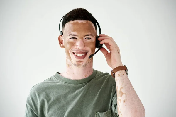 Estaría encantado de hablar con usted sobre nuestras ofertas. Retrato de estudio de un joven con vitiligo con auriculares sobre fondo blanco. — Foto de Stock