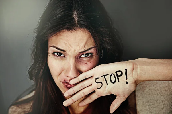 Es ist an der Zeit, häuslicher Gewalt ein Ende zu setzen. Porträt einer geprügelten und gequetschten jungen Frau mit dem Wort STOP auf ihrer Hand. — Stockfoto
