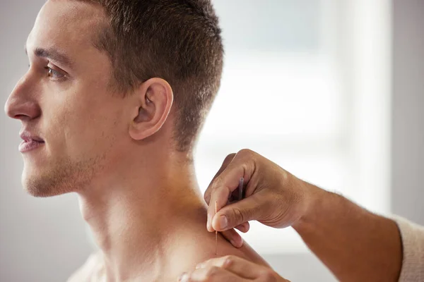 L'agopuntura è ottima per i muscoli doloranti. Girato di un giovane uomo ottenere agopuntura. — Foto Stock