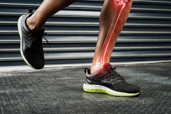 Neem altijd de beste schoenen die je kunt om letsel te voorkomen. Close-up schot van een atleet benen met cgi tonen een ontsteking in zijn scheenbeen en kuitbeen. — Stockfoto