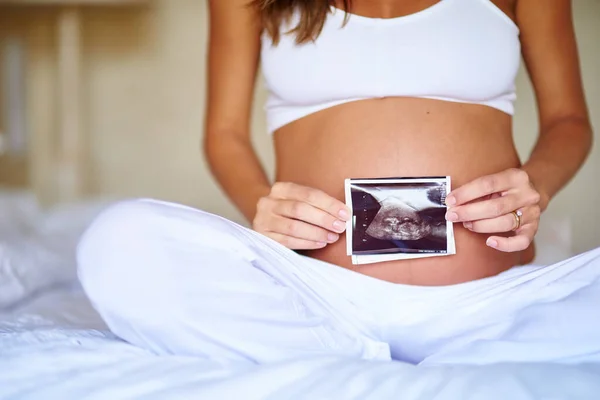 Shes excited about her little one. Shot of a pregnant woman holding a sonogram picture in front of her belly. — Stock Photo, Image