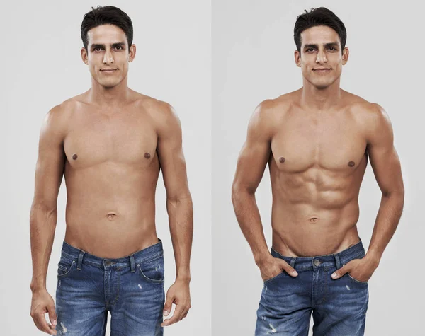 Dall'ordinario allo straordinario. Prima e dopo l'iniezione di un uomo dopo la dieta e l'esercizio fisico. — Foto Stock