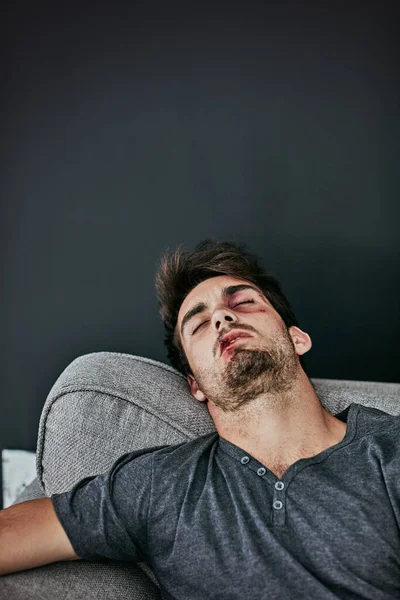 Golpeado y roto. Foto recortada de un joven golpeado y magullado durmiendo en el sofá. — Foto de Stock
