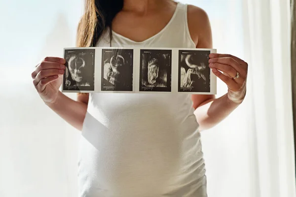 Il primo ritratto dei bambini. Girato di una donna incinta non identificabile che regge una serie di immagini ad ultrasuoni davanti a una finestra a casa. — Foto Stock
