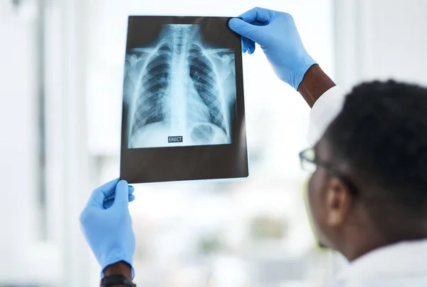 Знімок Молодого Лікаря Який Аналізує Рентгенівський Промінь Грудей Пацієнтів — стокове фото