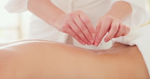 Fechar Mãos Uma Massagista Com Agulhas Acupuntura Tratando Uma Paciente — Vídeo de Stock