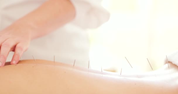 Closeup Female Masseuse Acupuncture Needles Treating Unknown Woman Patient Clinic — Stock Video