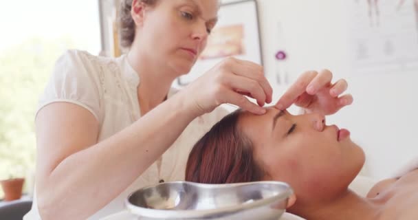 Profesionální Terapeuti Umístí Akupunkturní Jehly Klientovy Tváře Uvolní Napětí Obličejového — Stock video