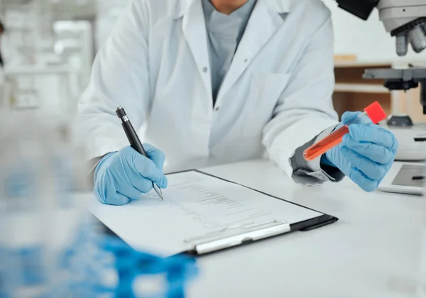 stock image Shot of a scientist holding a sample while making notes.