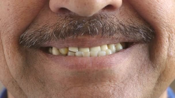 Людина Нерівними Жовтими Зубами Посміхається Докази Перед Стоматологічним Лікуванням Дорослого — стокове відео