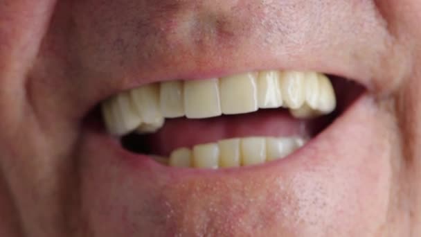 Крупный План Смеющегося Мужчины Показывающего Зубы Протезы После Стоматологического Лечения — стоковое видео