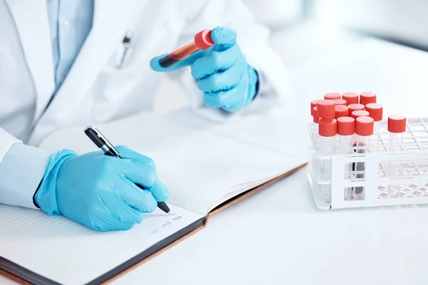 Hands of a scientist writing notes about a research sample, holding a test tube. Scientist working on chemistry experiment, holds vial of blood. Medical expert planning, holding tube of chemicals.