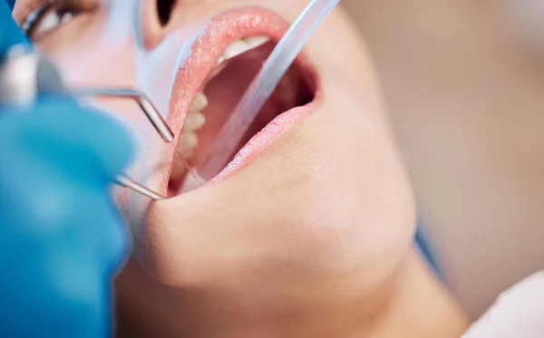 Una Donna Che Pulire Denti Dal Dentista — Foto Stock