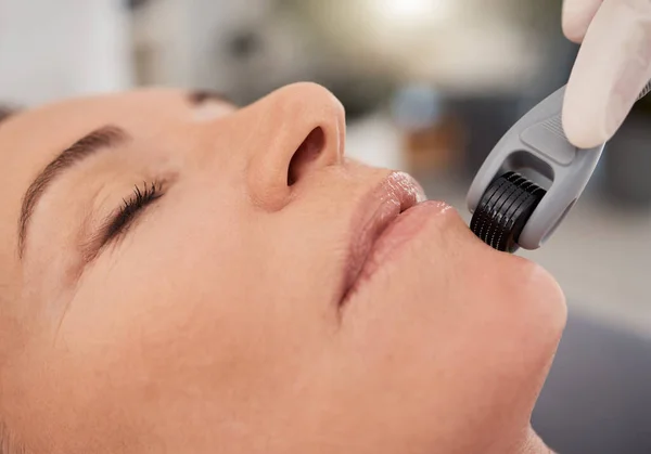 Working on skin regeneration and scar repair. Closeup shot of a mature woman enjoying a micro-needling treatment at a spa