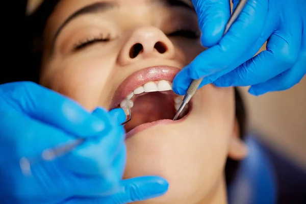 Whole Tooth Nothing Tooth Young Woman Having Dental Procedure Performed —  Fotos de Stock