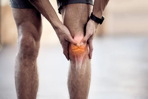 Тренуваннях Слухаєте Своє Тіло Невпізнаваний Чоловік Тримає Ногу Болю Під — стокове фото