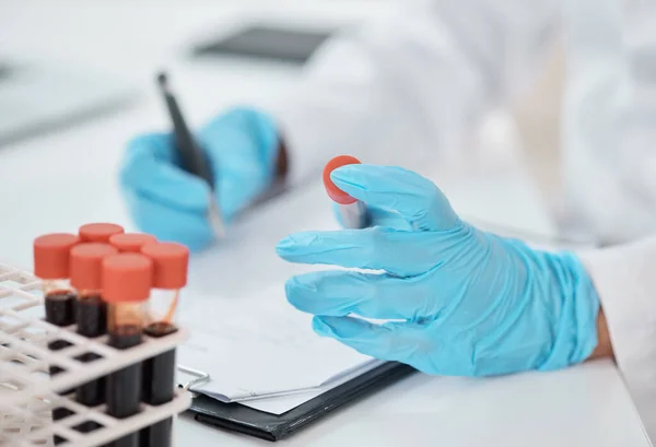 New samples have come in for the case study at hand. Closeup shot of an unrecognisable scientist writing notes while working with samples in a lab