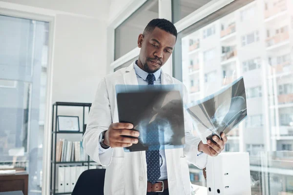 I can definitely tell the difference between the two scans. a young doctor examining an x-ray in an office