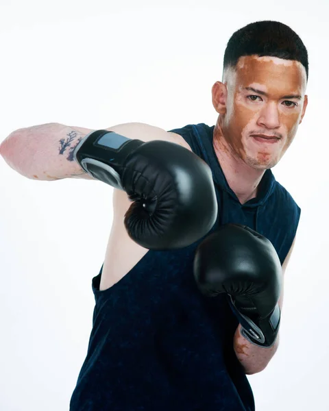 Boxing Therapy Portrait Shot Handsome Young Male Boxer Vitiligo Posing — 图库照片