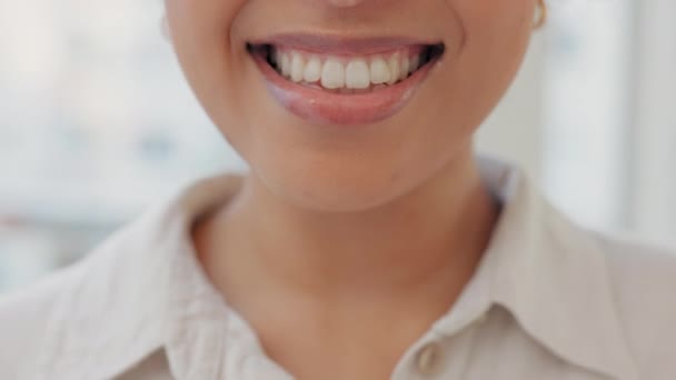 Белые Зубы Смеющаяся Улыбка Крупный План Девушки После Процедуры Отбеливания — стоковое видео
