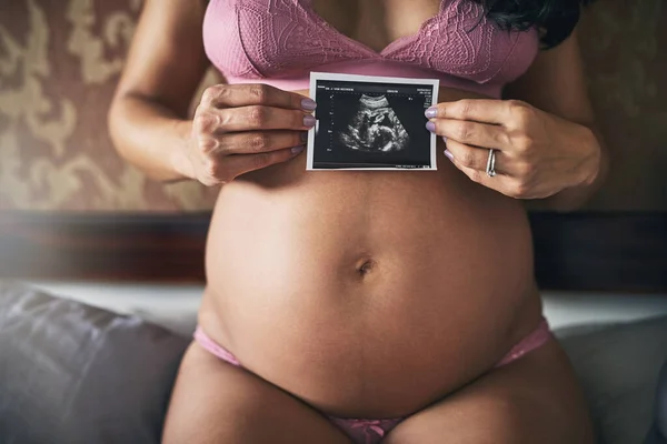 Theres Healthy Baby Way Unrecognizable Pregnant Woman Kneeling Her Bed — Foto Stock