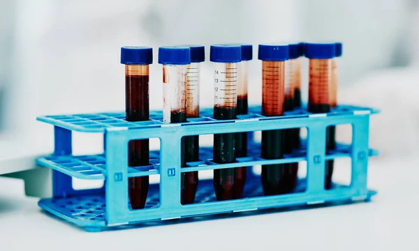 Крупним Планом Кров Пробірка Або Медичні Дослідження Науковій Праці Тестування — стокове фото