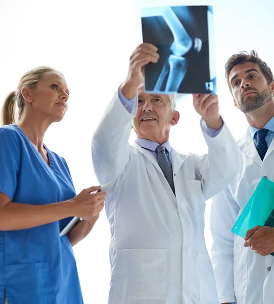 Тепер Вони Чітко Бачать Група Лікарів Які Вивчають Рентгенівський Знімок — стокове фото