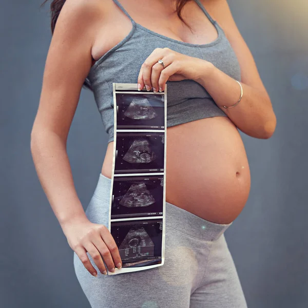 Babys First Picture Pregnant Woman Holding Her Sonogram Picture Gray — Stock fotografie