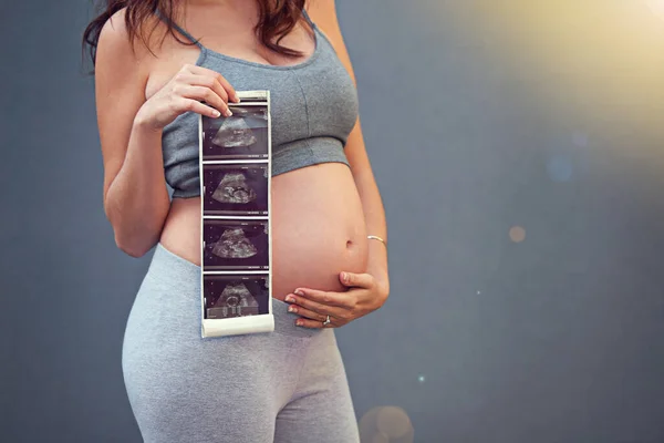 Happiness Way Pregnant Woman Holding Her Sonogram Picture Gray Background — Foto Stock