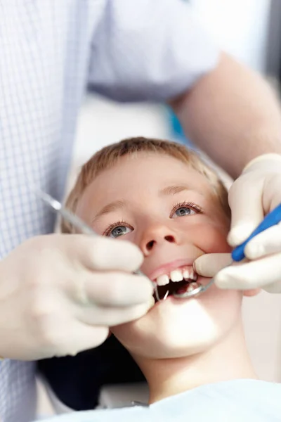 男孩的牙科治疗 在诊所接受牙科治疗的可爱男孩的高透视 — 图库照片