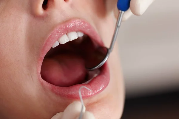 Examen Dental Primer Plano Paciente Femenina Durante Tratamiento Dental — Foto de Stock