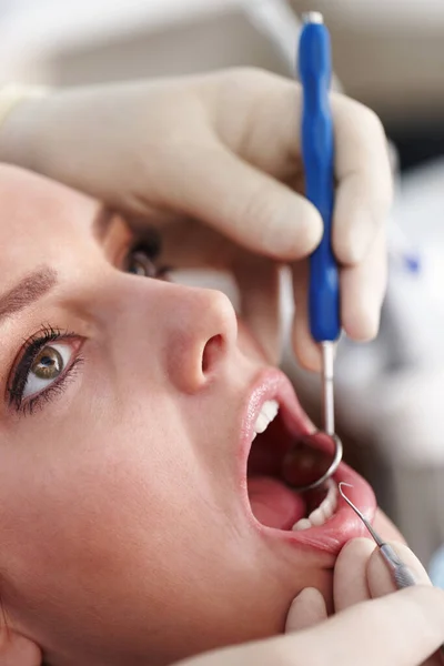 Limpieza Dental Primer Plano Paciente Femenina Clínica Para Tratamiento Dental — Foto de Stock